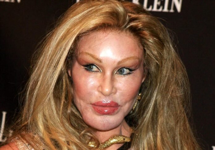Remembering Jocelyn Wildenstein: The 'Catwoman' Who Captivated the World