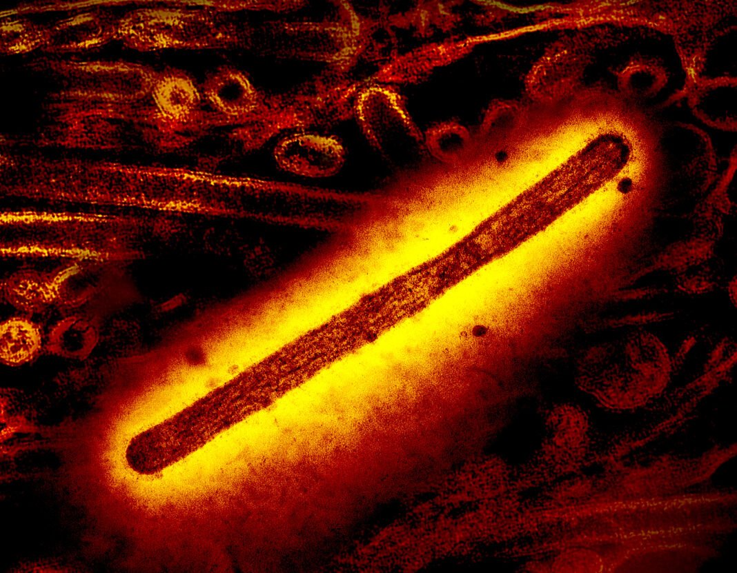 Understanding Bird Flu Risks: WHO Addresses Public Concerns After First U.S. Death Understanding Bird Flu Risks: WHO Addresses Public Concerns After First U.S. Death