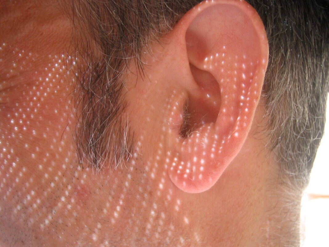 ear-wiggling muscle activates while listening ear-wiggling muscle activates while listening