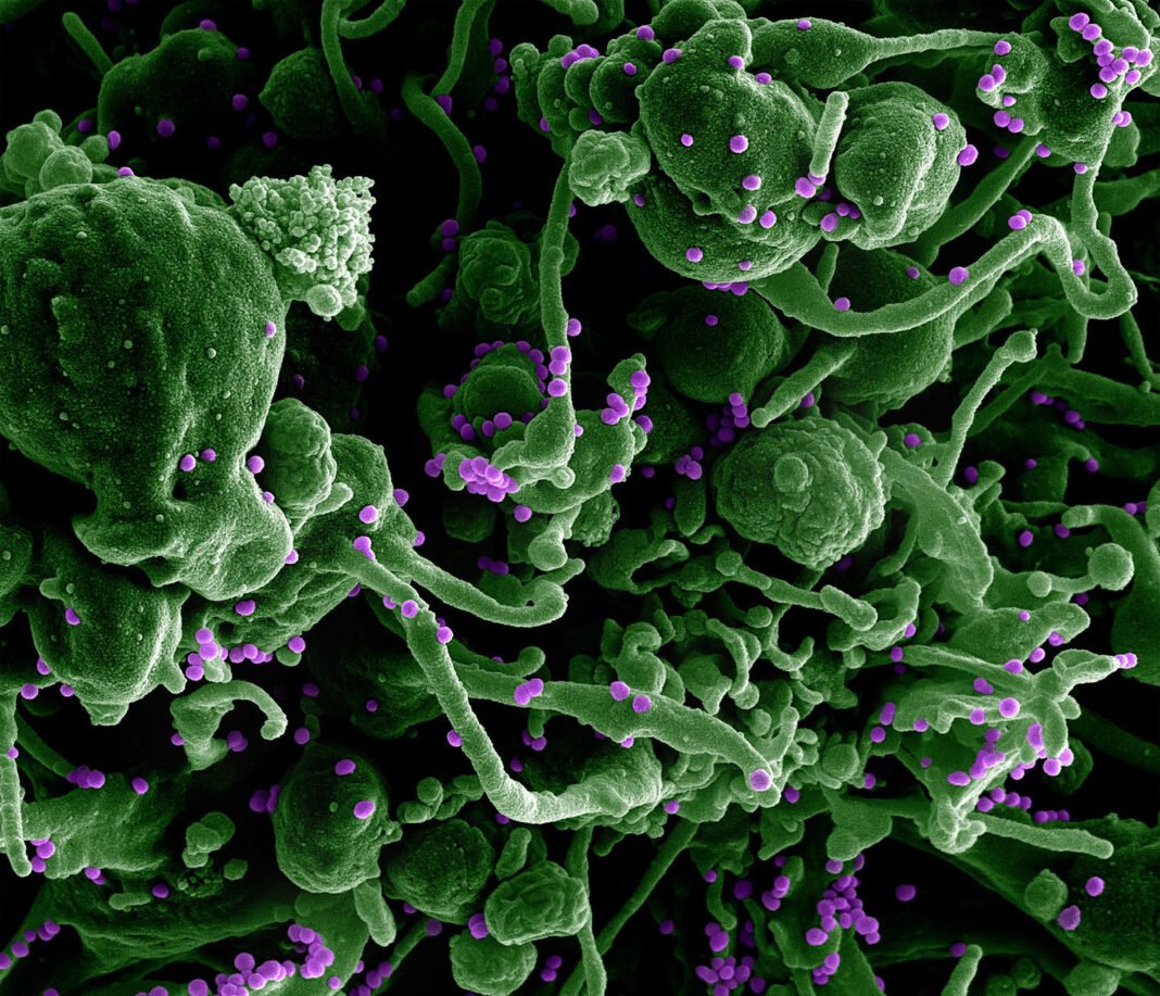 Lassa Virus