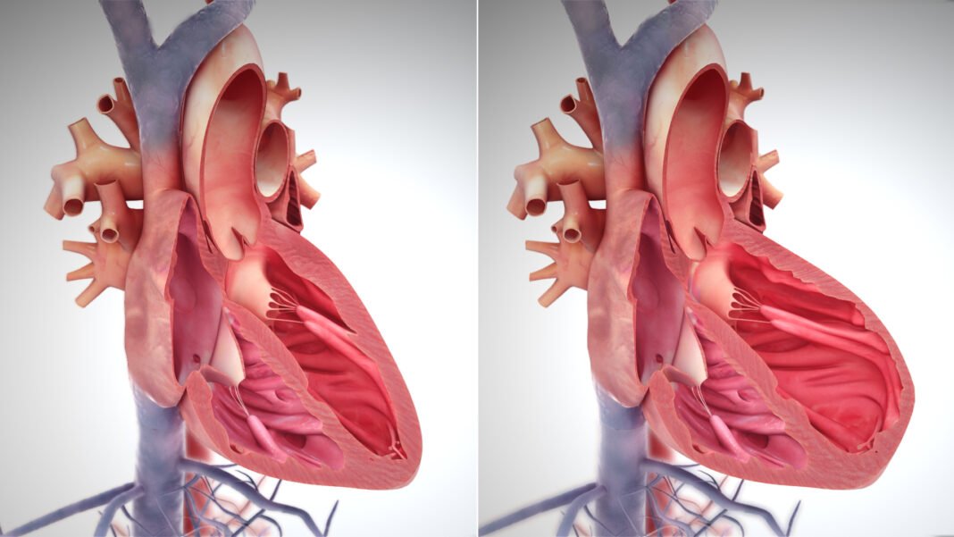 Heart Failure Outcomes Heart Failure Outcomes