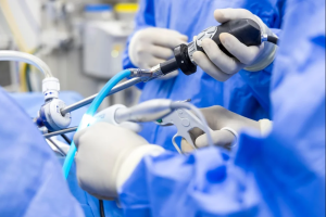Rectal Cancer Treatment