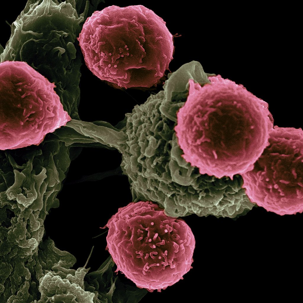 Cancer Immunotherapy Cancer Immunotherapy