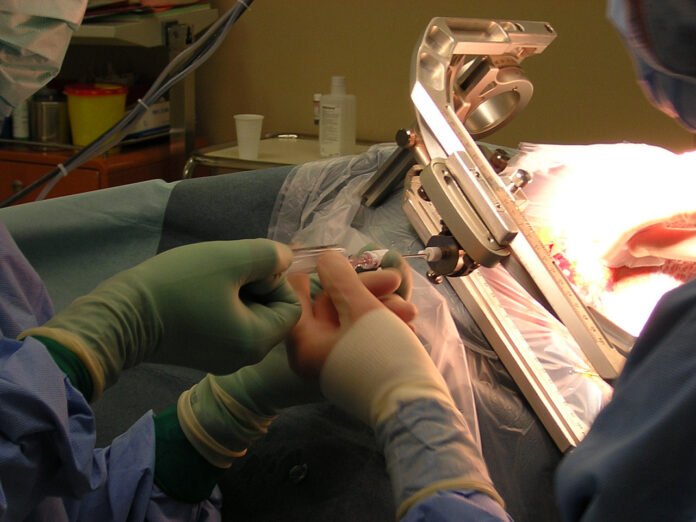 Biopsies