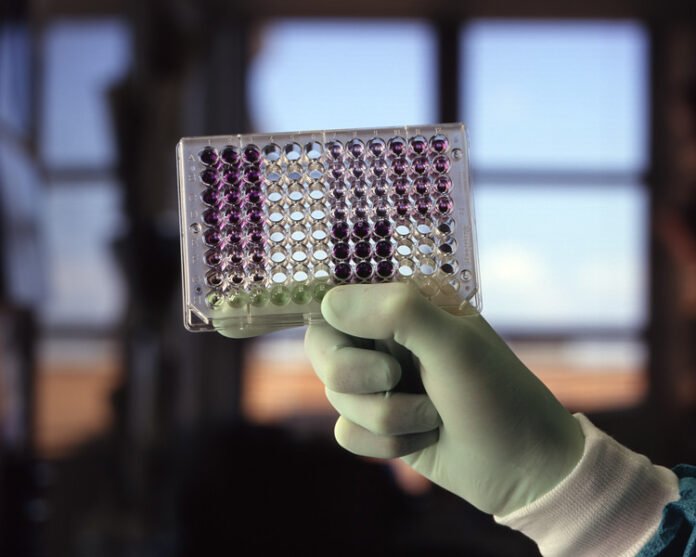 Protein Quantification