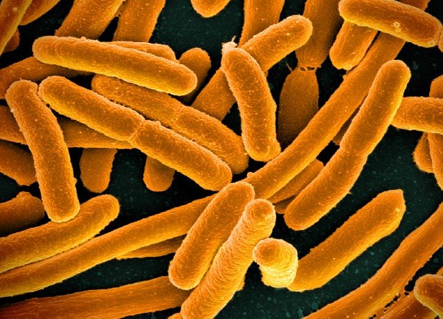 Bacteria