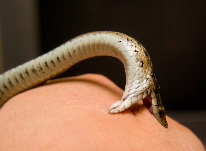 Snakebite
